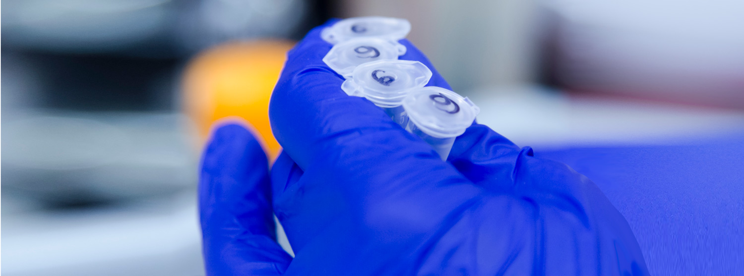 Gloved hand holding test tubes