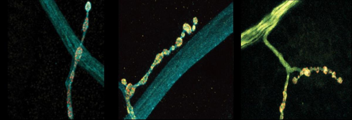 Individual neurons mix multiple RNA edits of key synapse protein, fly study finds