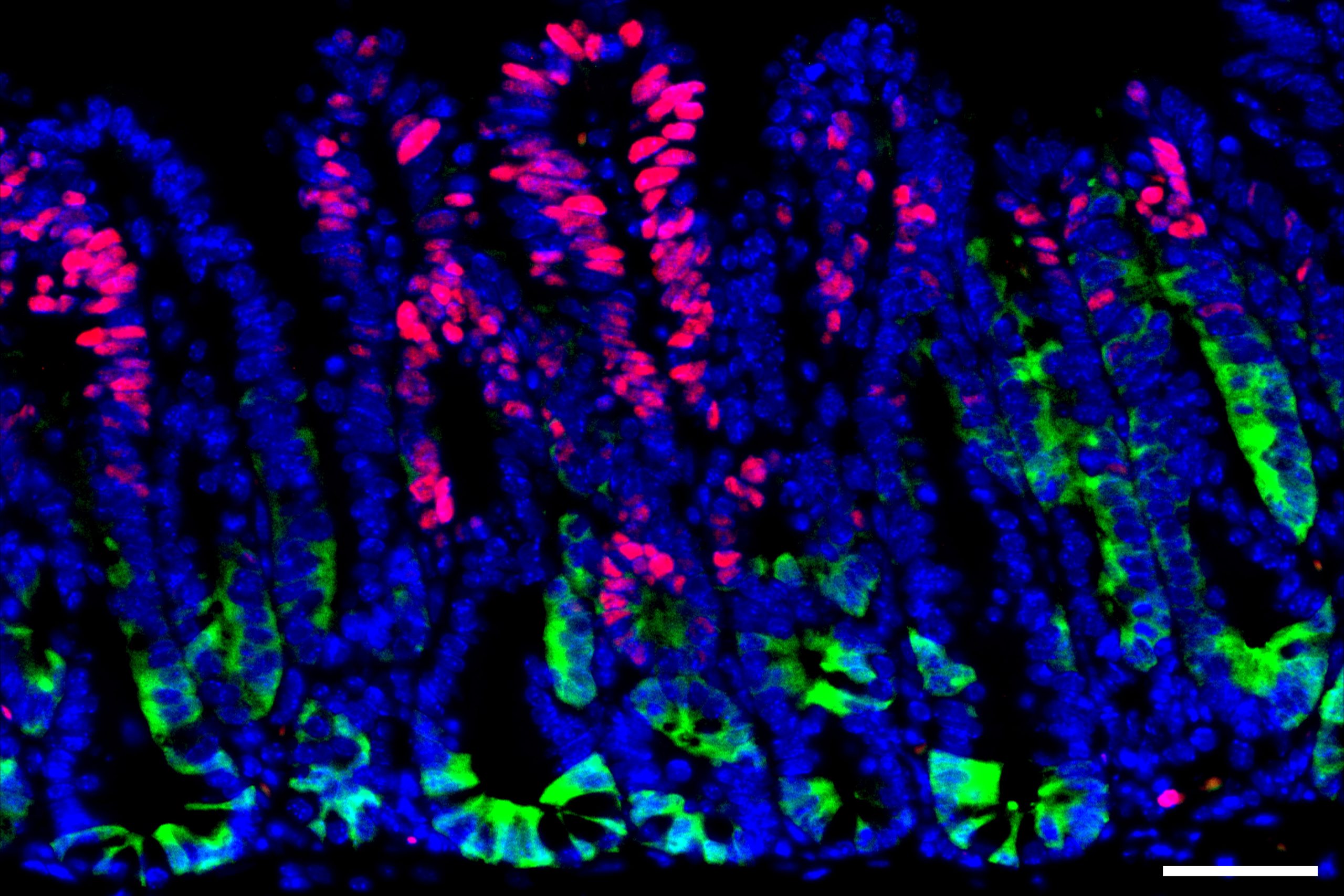 How early-stage cancer cells hide from the immune system