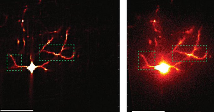 Microscope system sharpens scientists’ view of neural circuit connections