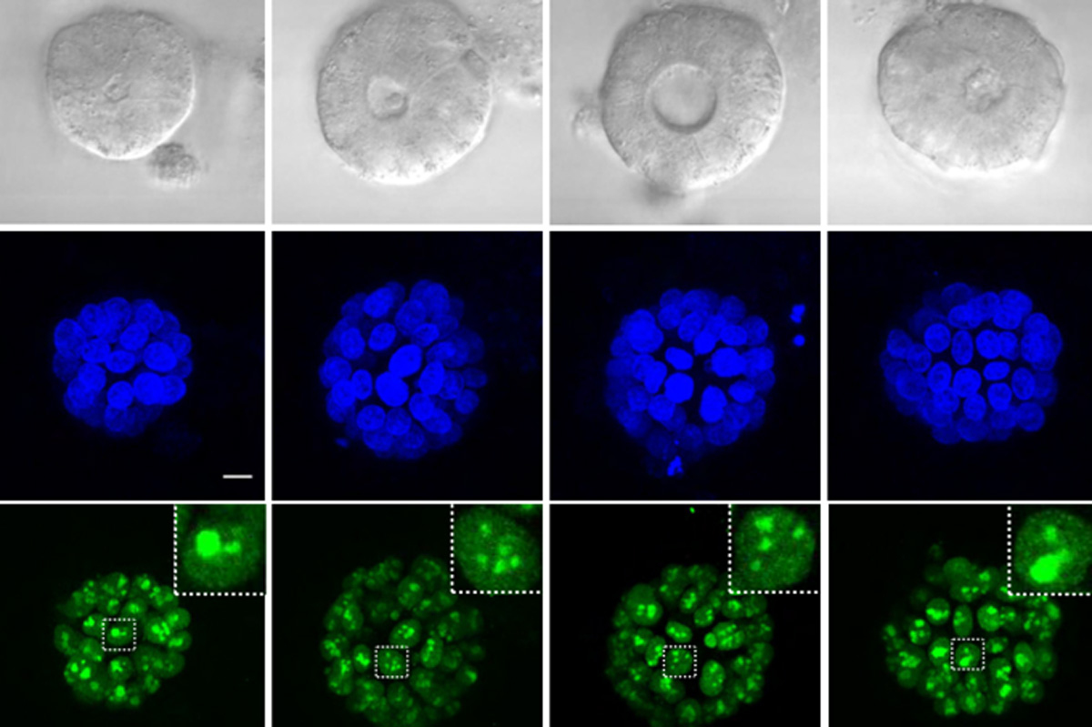 Cancer biologists discover a new mechanism for an old drug