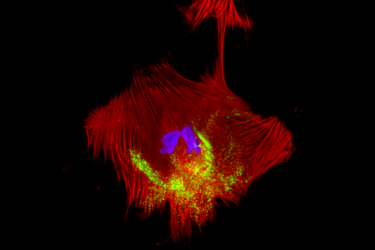 Cellular interactions help explain vascular complications due to COVID-19 virus infection